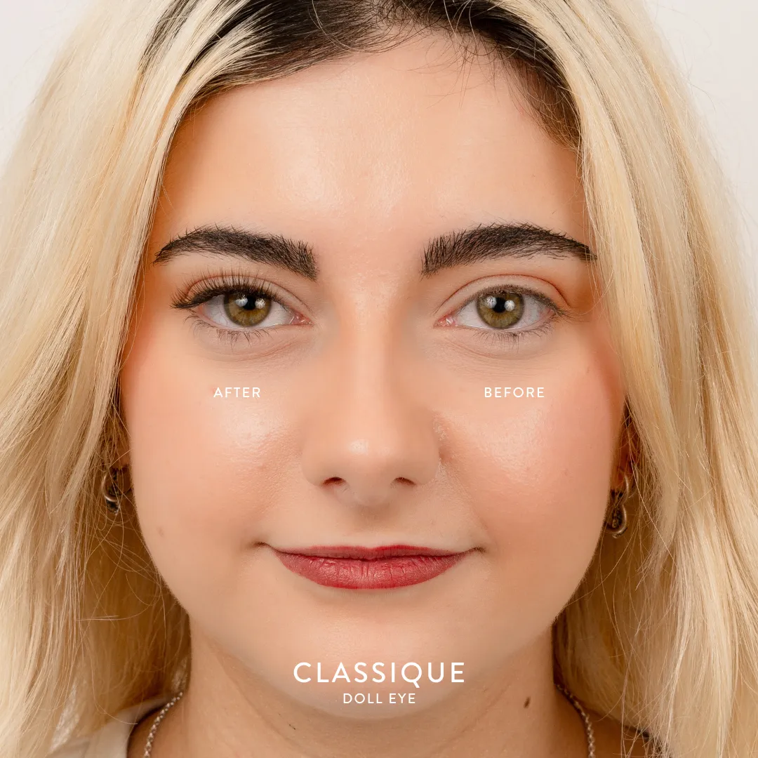 Mixed Length Clusters - Classique