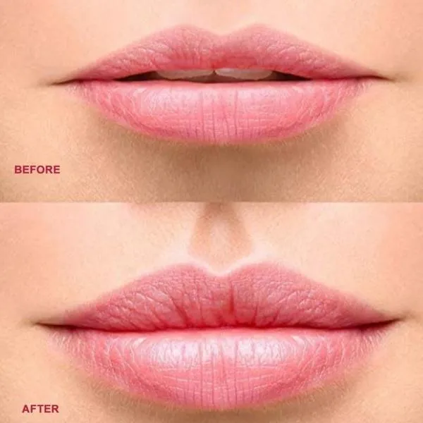 Natural Kylie Lip Plumper Device Automatic Handheld Lip Enhancer Tool
